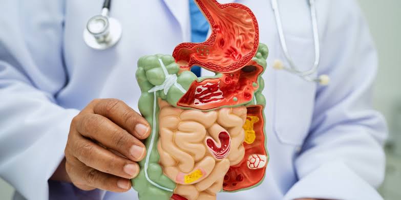 Saúde digestiva e Síndrome do Intestino Irritável - Dr. Klevin Canuto